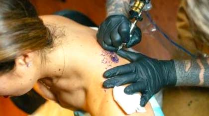 Tatuajes y depilación láser